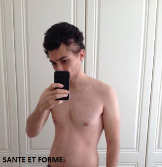 Cancer du cerveau guérison et survie avec un régime cétogène sans glucides.